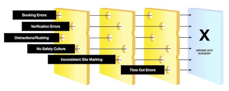 Swiss cheese model